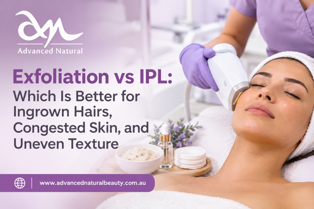 IPL treatment